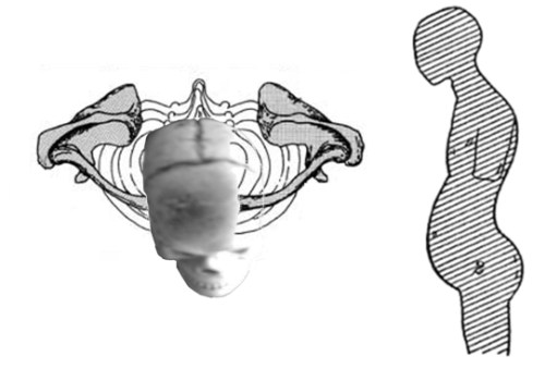 Fig.1