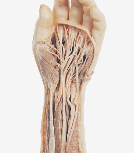 C0055405-Human_hand_dissection_showing_muscles-SPL