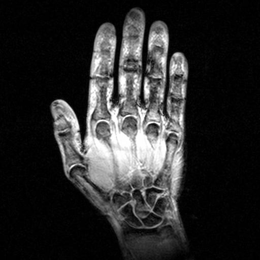 hand_4