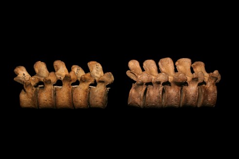 Lumbar_Vertebra